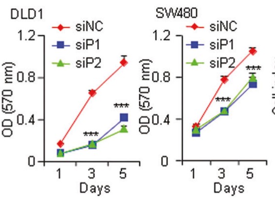MTT assay in control and PDE4DIP-silenced DLD1 and SW480 cells.jpg